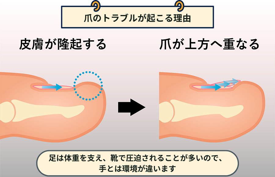 爪が上方向に重なり変形していく構造
