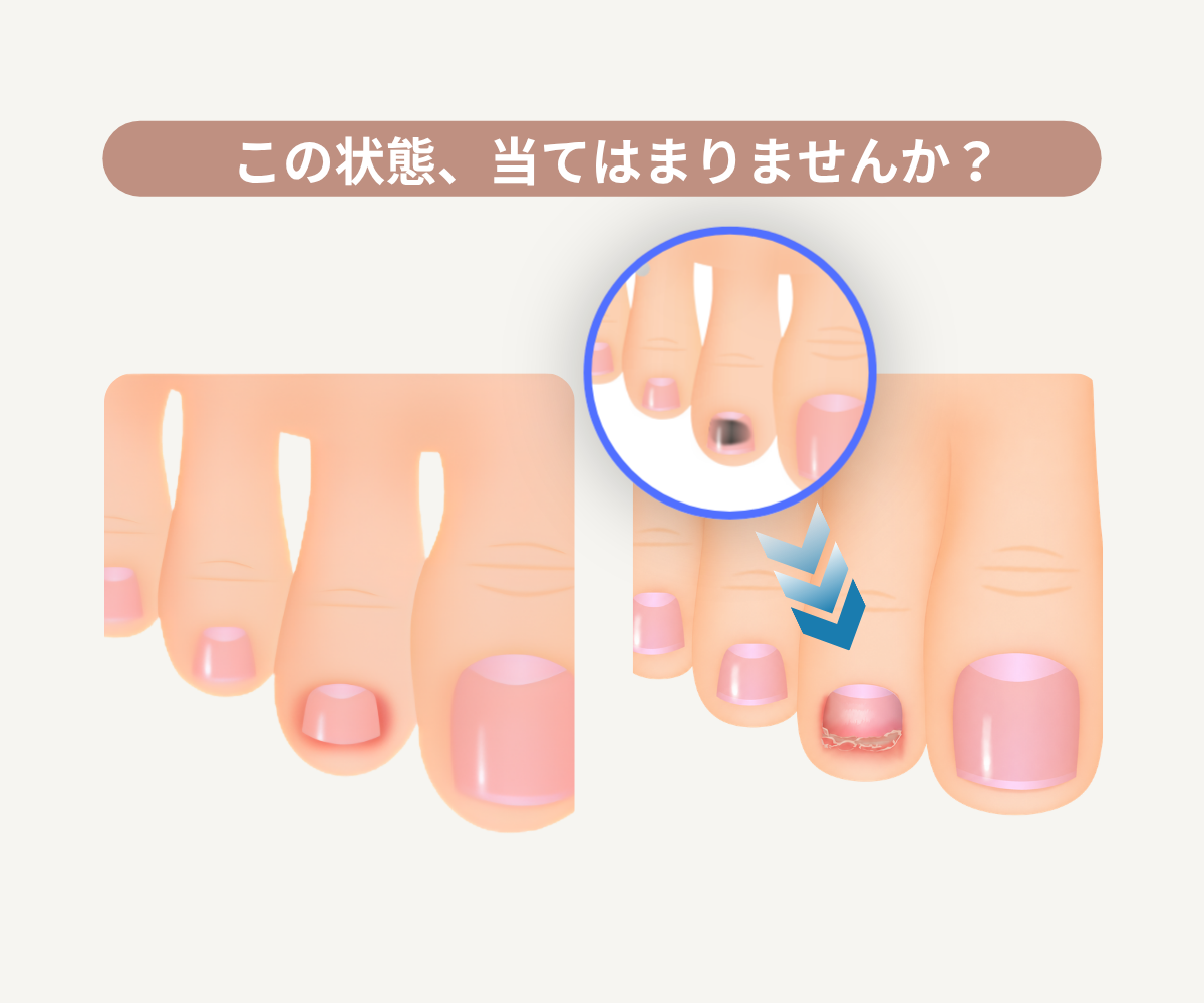 この状態、当てはまりませんか