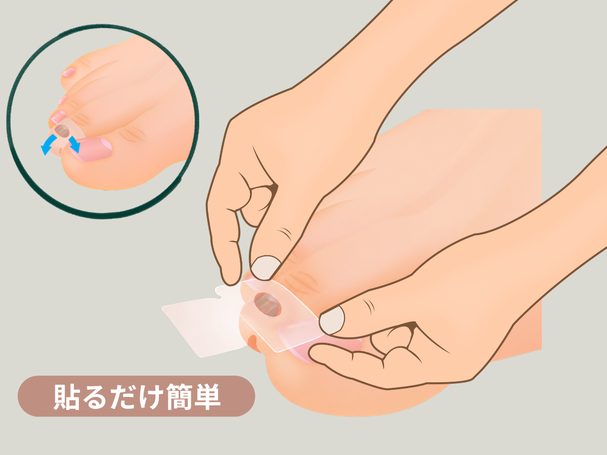 爪伸び育て～ぷの使用方法 貼るだけ簡単